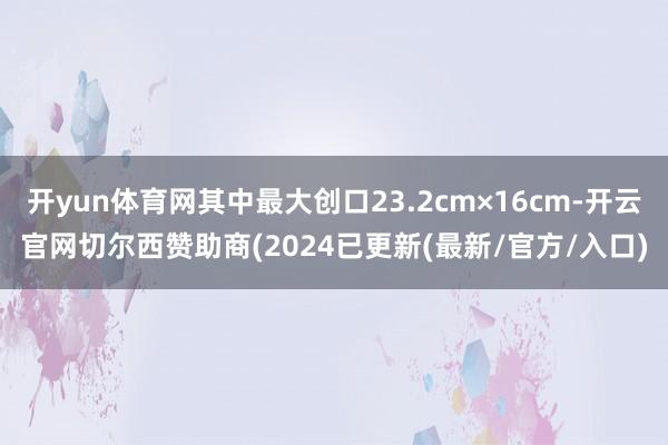 开yun体育网其中最大创口23.2cm×16cm-开云官网切尔西赞助商(2024已更新(最新/官方/入口)